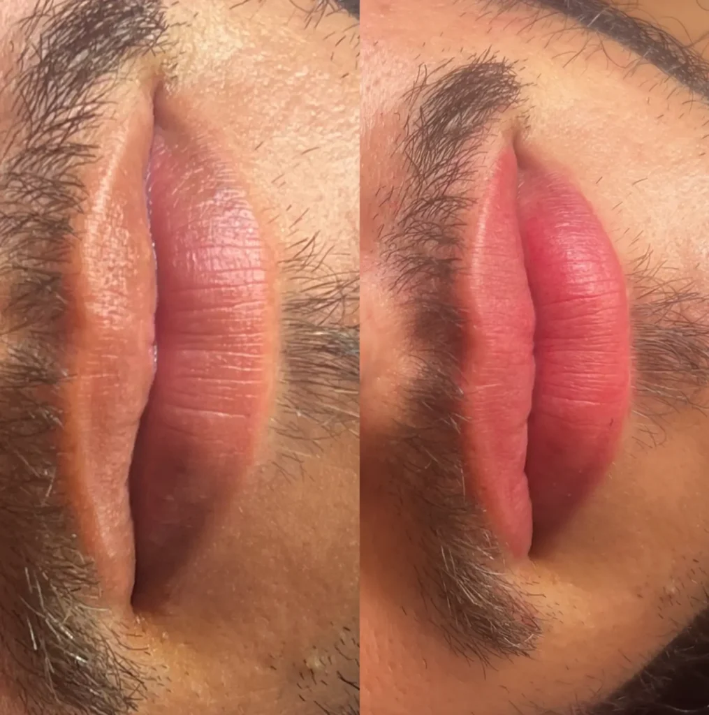 Is it Safe for All Skin Types