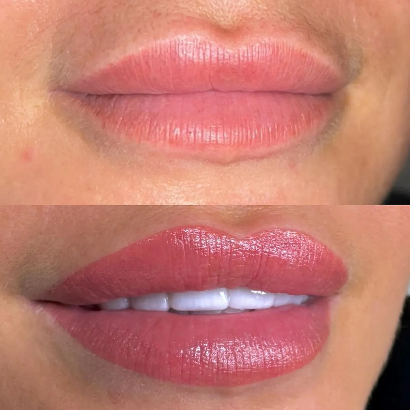 Supa Society | Who Can’t Get a Lip Blush Tattoo? Recent Cosmetic or Skin Procedures