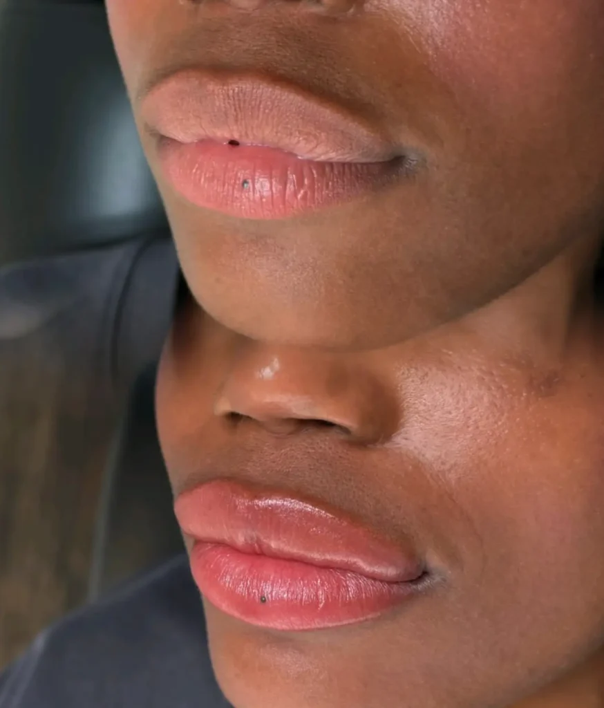 When Side Effects Are a Sign of Trouble